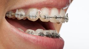 Orthodontics