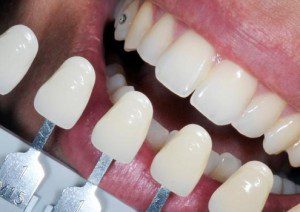 Protetica dentara